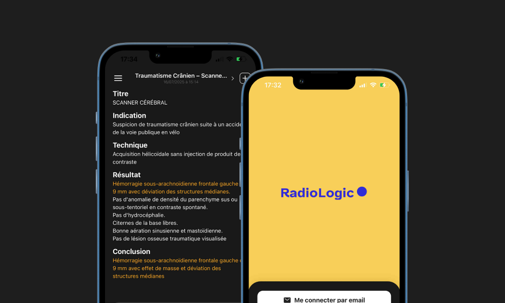 Aperçu application mobile RadioLogic